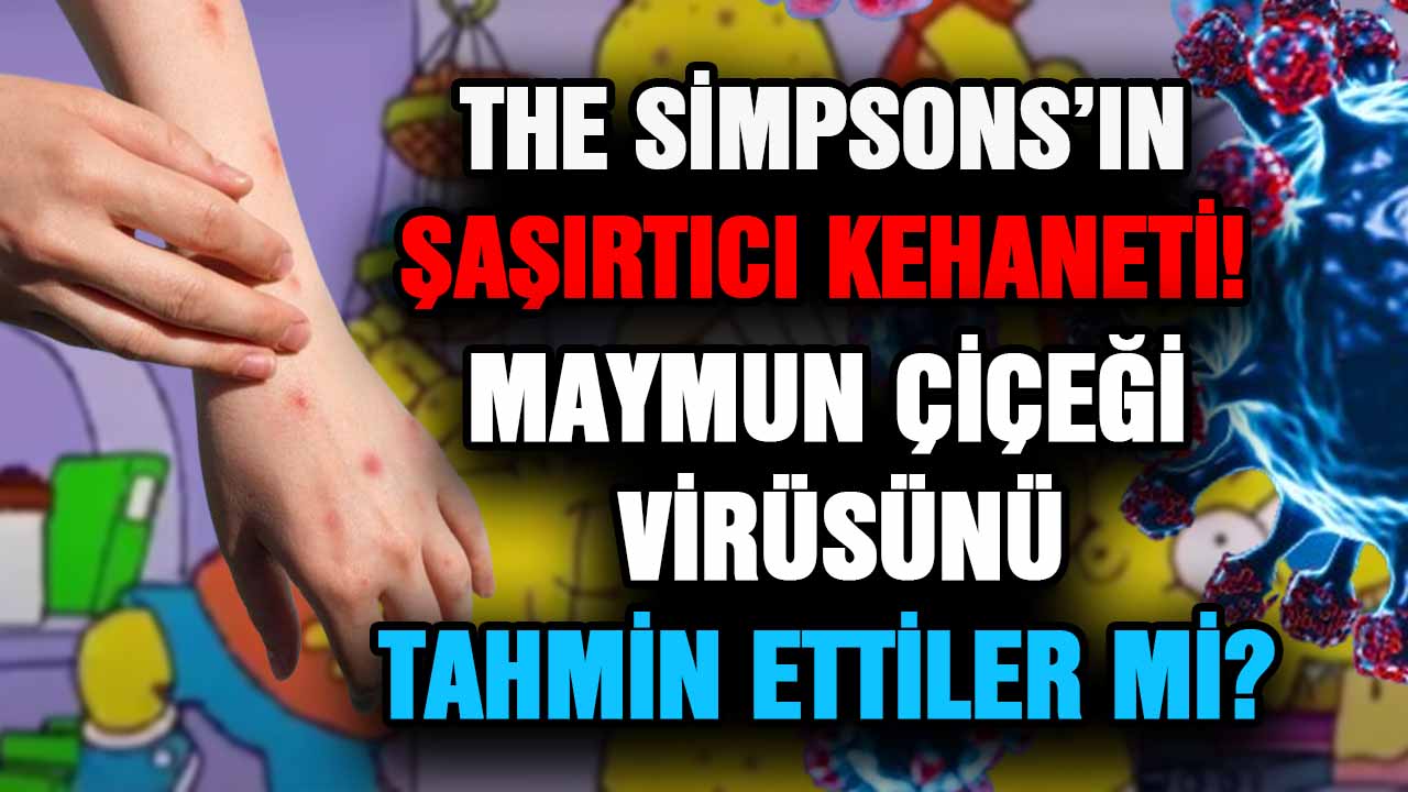 The Simpsons’ın Şaşırtıcı Kehaneti: Maymun Çiçeği  virüsünü tahmin ettiler mi?