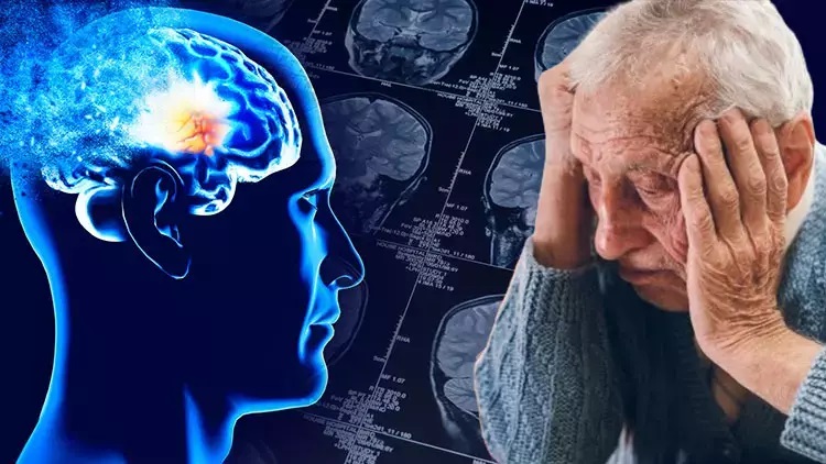 Alzheimer’ın İlk Belirtisini Kaçırmayın